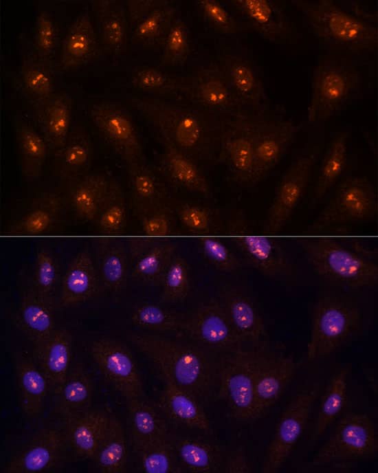 Protein Phosphatase 1C gamma Antibody - BSA Free