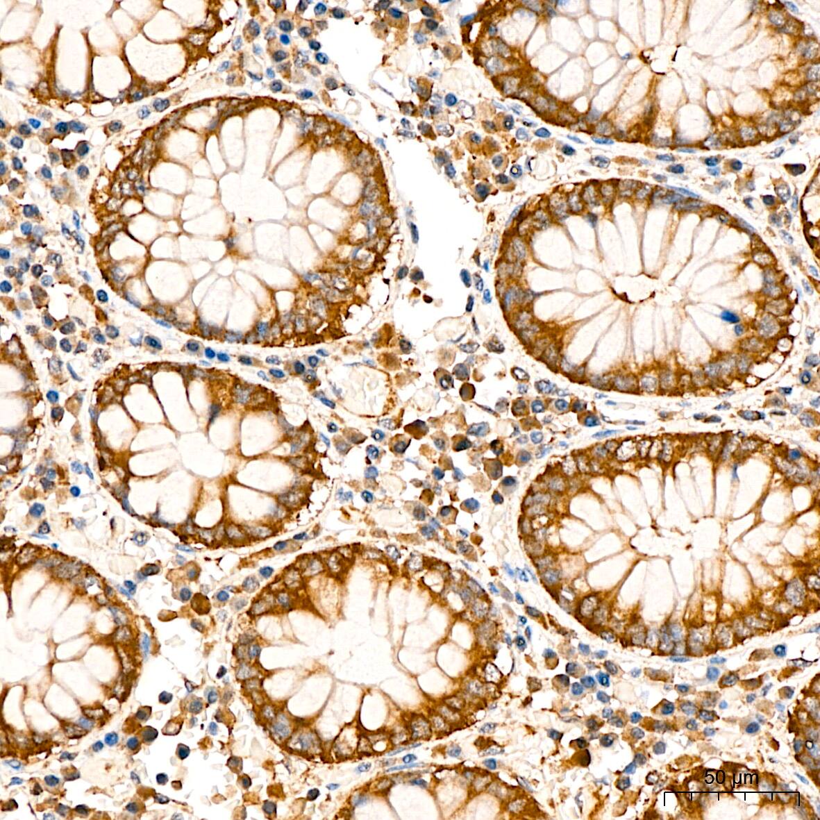 Lactate Dehydrogenase B Antibody - BSA Free