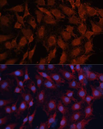 HSP40/DNAJB1 Antibody - BSA Free