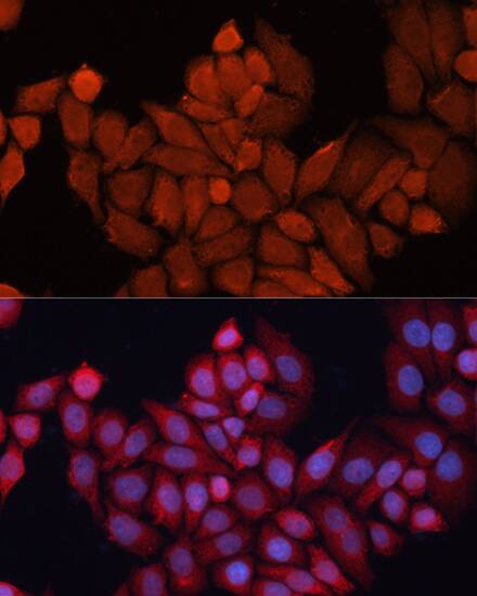 HSP40/DNAJB1 Antibody - BSA Free