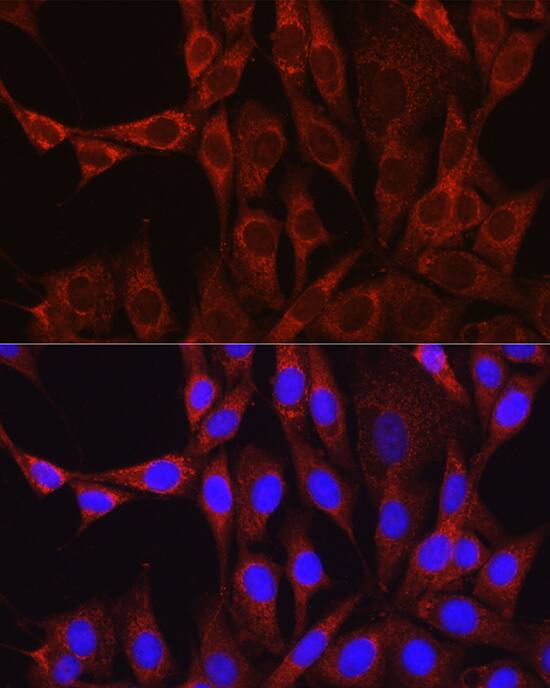 Glutamine Synthetase Antibody - BSA Free