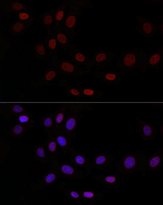 Thymopoietin/LAP2 Antibody - Azide and BSA Free