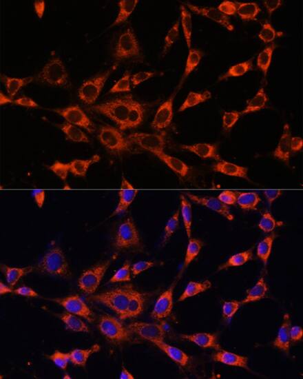 IP3R3 Antibody - Azide and BSA Free