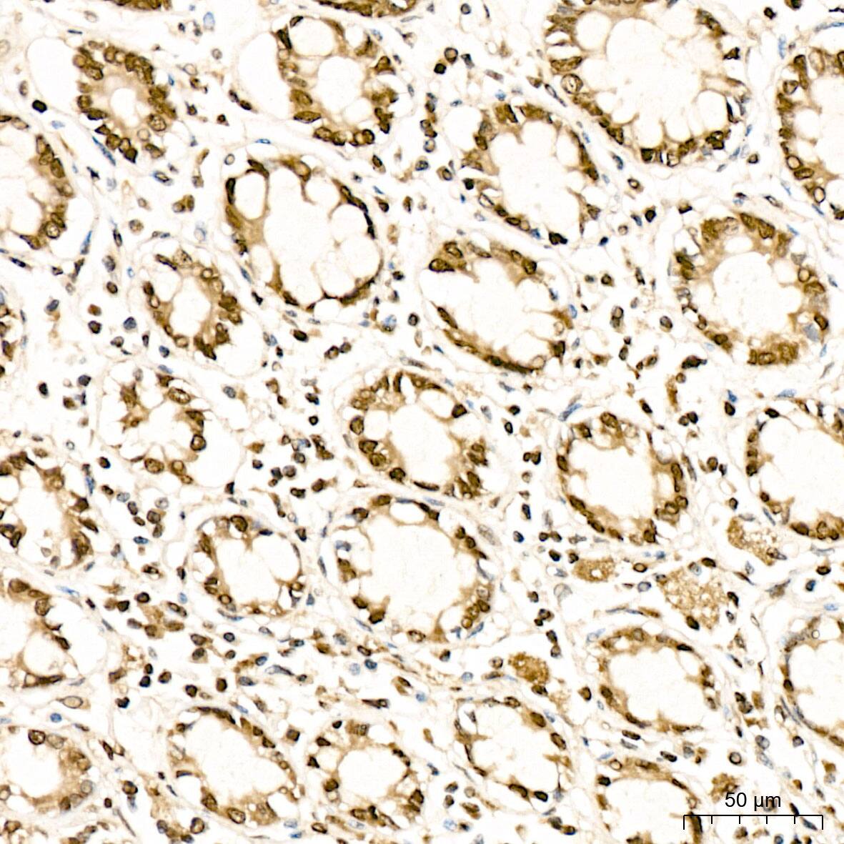 Methionine Sulfoxide Reductase B Antibody - BSA Free