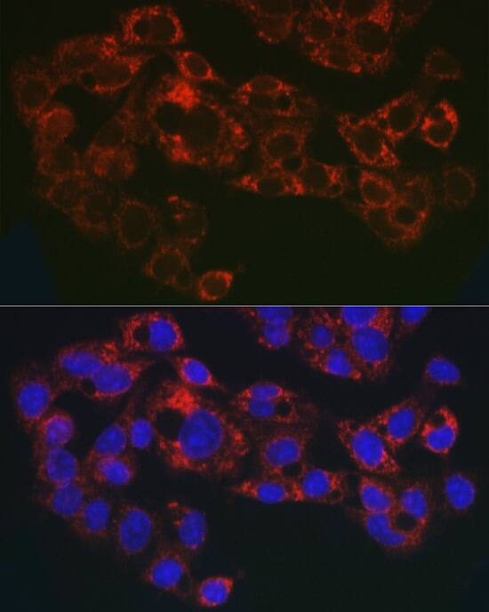 GPI-PLD/GPLD1 Antibody - Azide and BSA Free