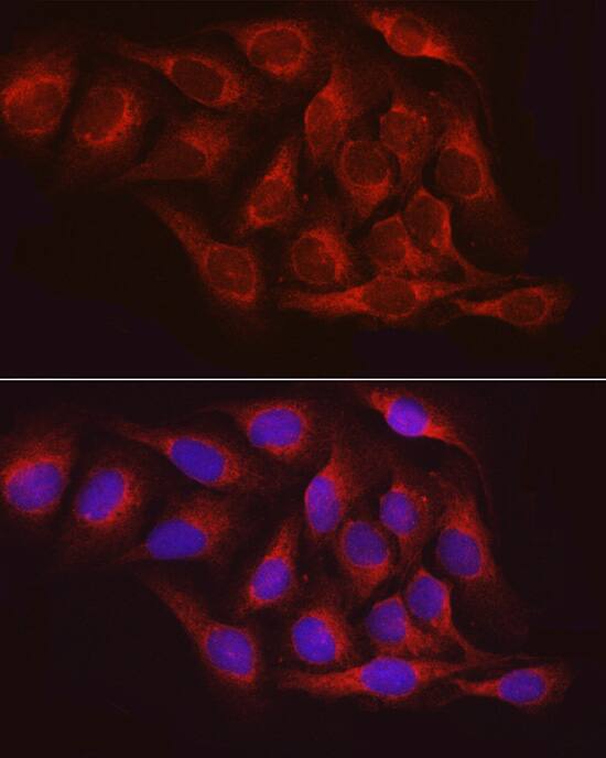 PTP1B/PTPN1 Antibody - Azide and BSA Free