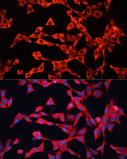 GDI2 Antibody - BSA Free