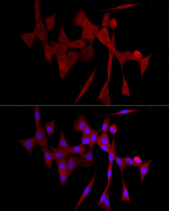 GLT25D1 Antibody - Azide and BSA Free