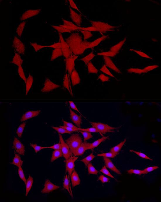 GLT25D1 Antibody - Azide and BSA Free