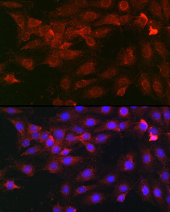 Heparanase/HPSE Antibody - Azide and BSA Free