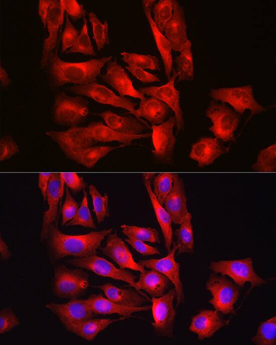 Glutathione Synthetase Antibody - Azide and BSA Free