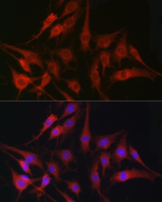 Fascin Antibody - BSA Free