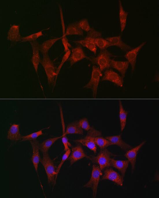 Fascin Antibody - BSA Free