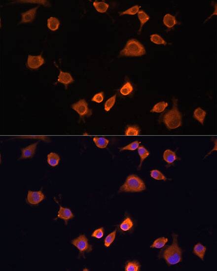 NF2/Merlin Antibody - BSA Free