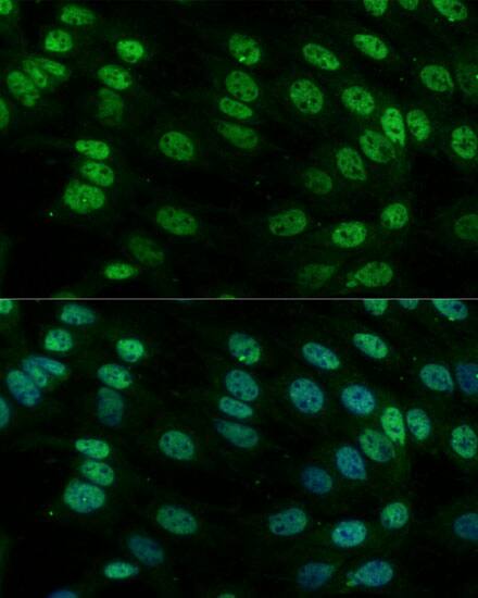 hnRNP M Antibody - Azide and BSA Free