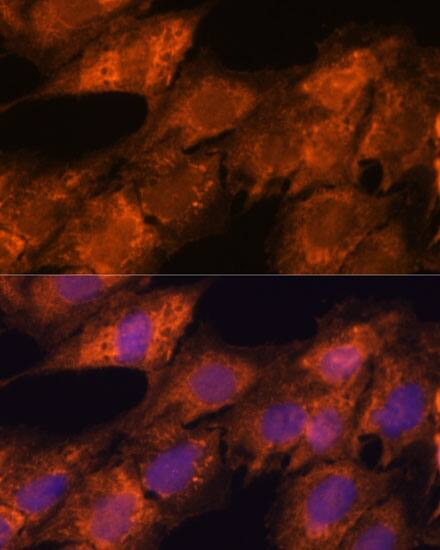 Importin4 Antibody - Azide and BSA Free
