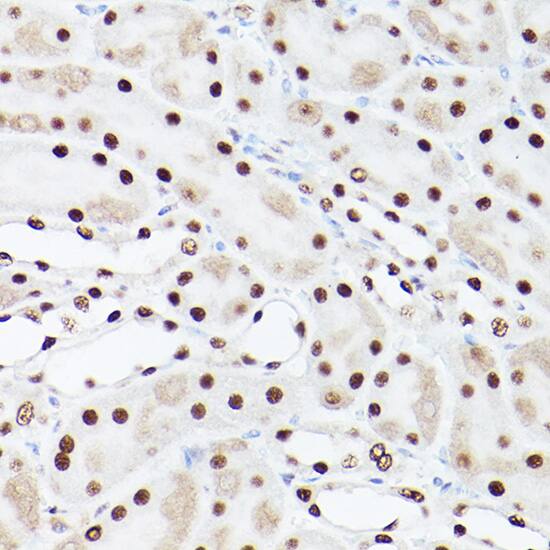 PA28 Activator gamma Subunit/PSME3 Antibody - Azide and BSA Free