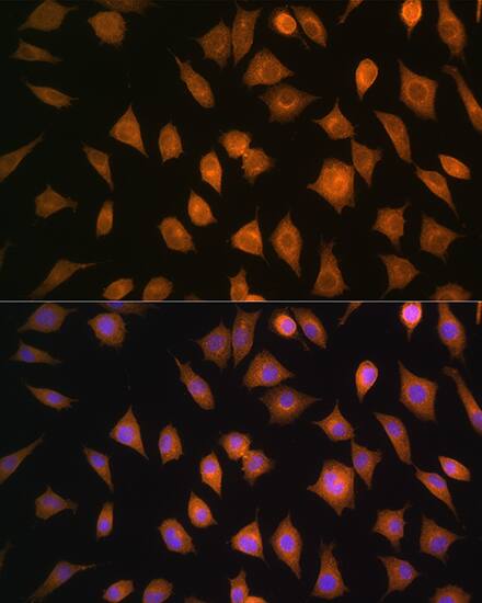 ELOVL4 Antibody - Azide and BSA Free