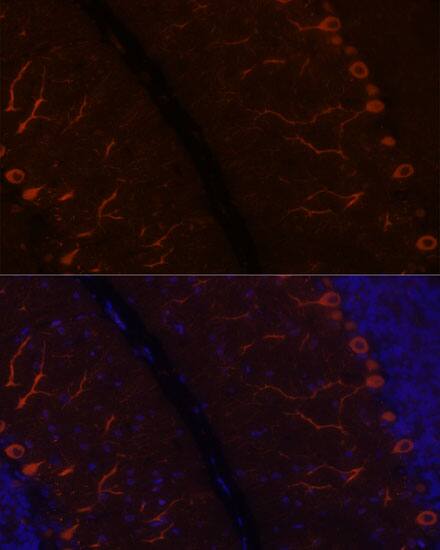 KAL1 Antibody - Azide and BSA Free