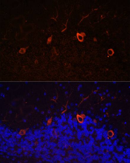 KAL1 Antibody - Azide and BSA Free