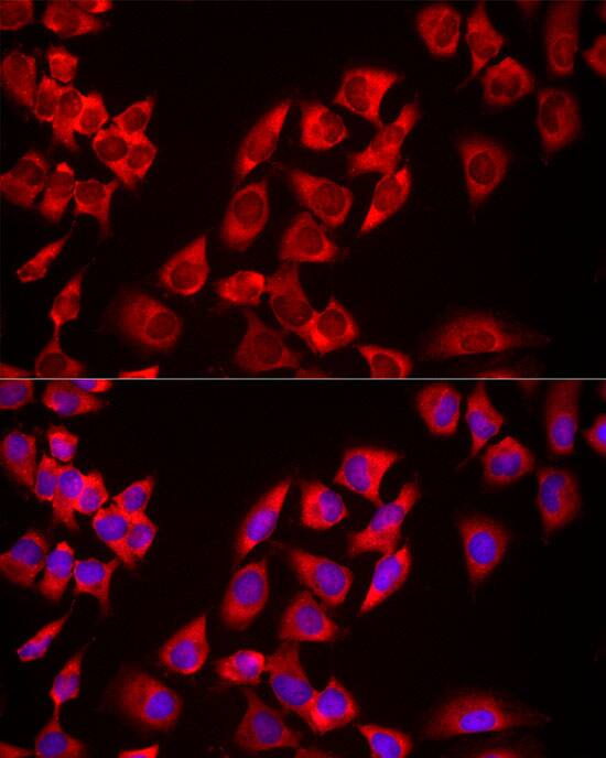 USP21 Antibody - Azide and BSA Free