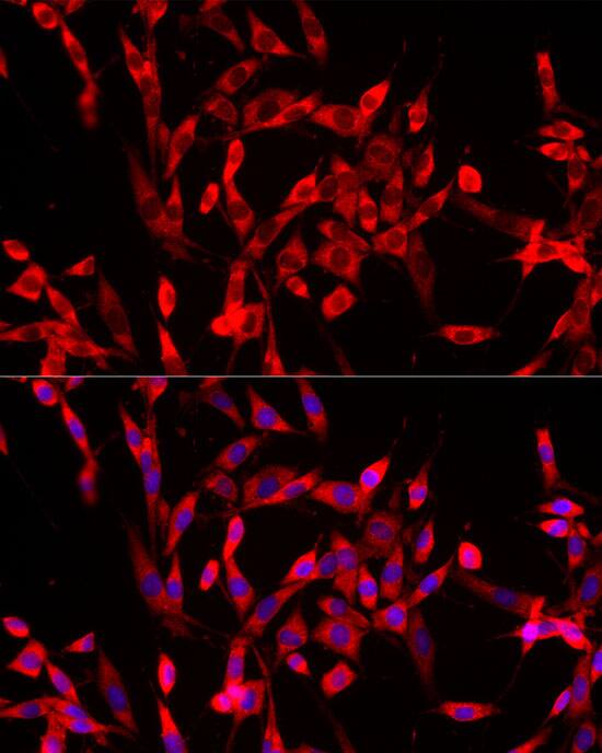 USP21 Antibody - Azide and BSA Free