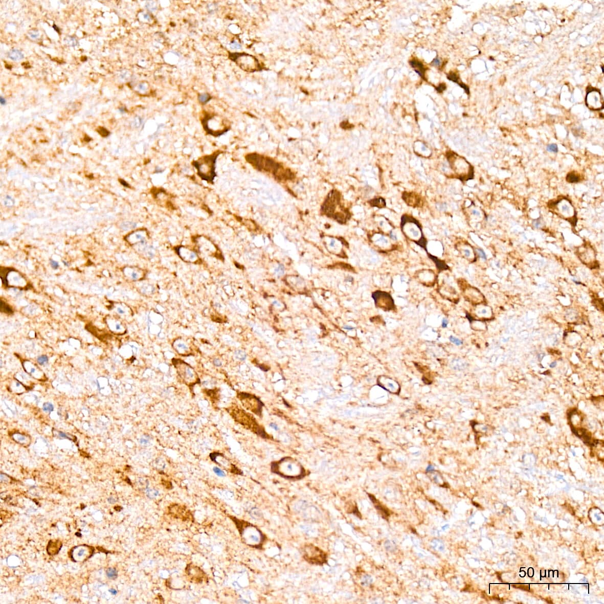 FUNDC1 Antibody - Azide and BSA Free