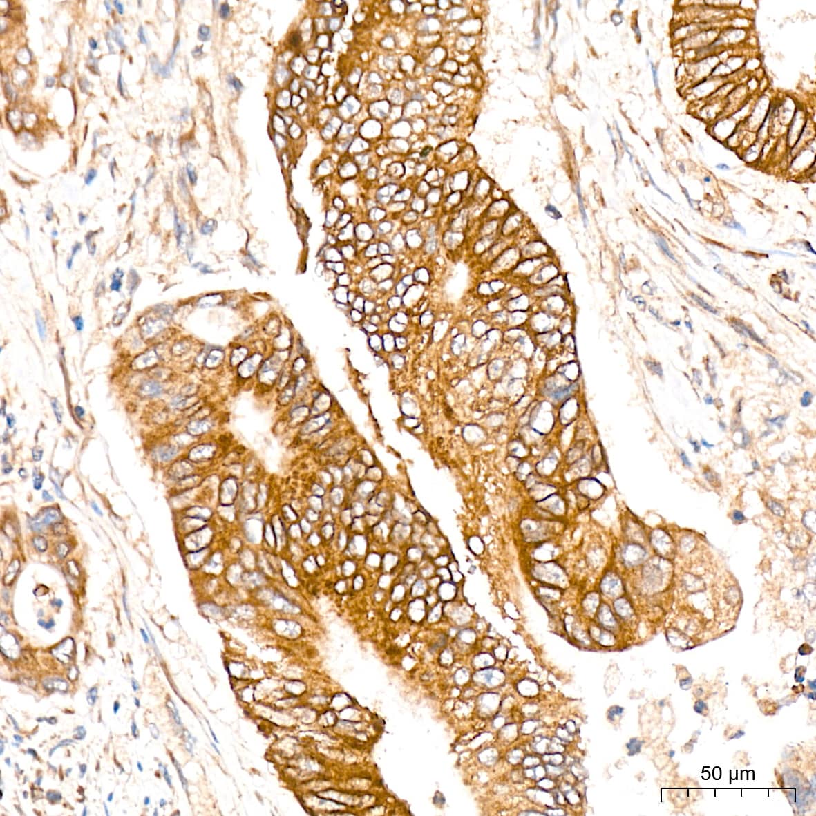 FUNDC1 Antibody - Azide and BSA Free