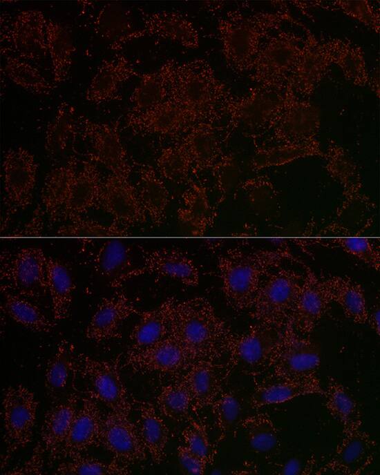 GLS2 Antibody - Azide and BSA Free