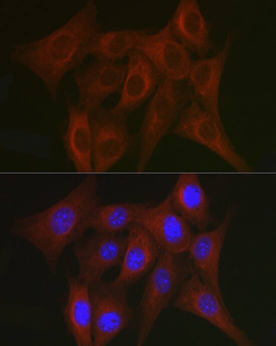 TRAF7 Antibody - Azide and BSA Free