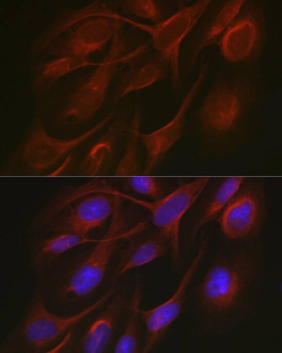 TRAF7 Antibody - Azide and BSA Free