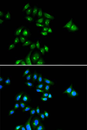 PHC3 Antibody - BSA Free