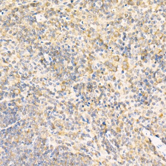 RPLP2 Antibody - BSA Free