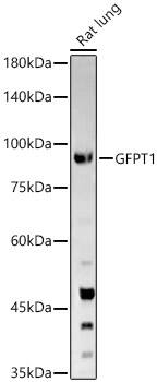 GFPT1 Antibody - BSA Free