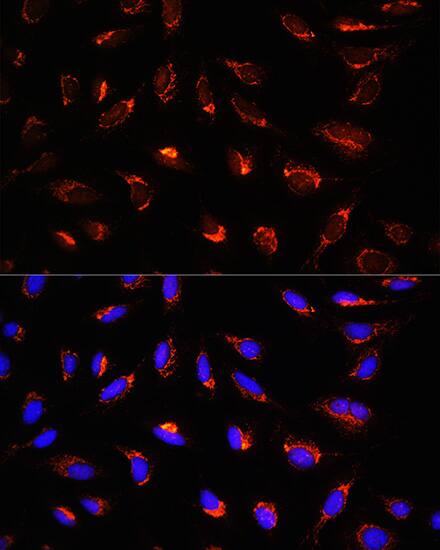GCSH Antibody - Azide and BSA Free