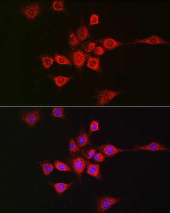 METTL4 Antibody - Azide and BSA Free