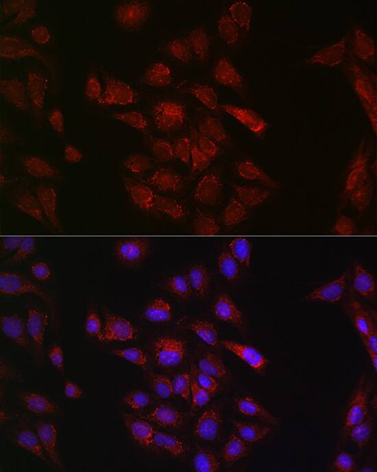 METTL4 Antibody - Azide and BSA Free