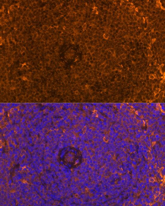 FAM65B Antibody - Azide and BSA Free