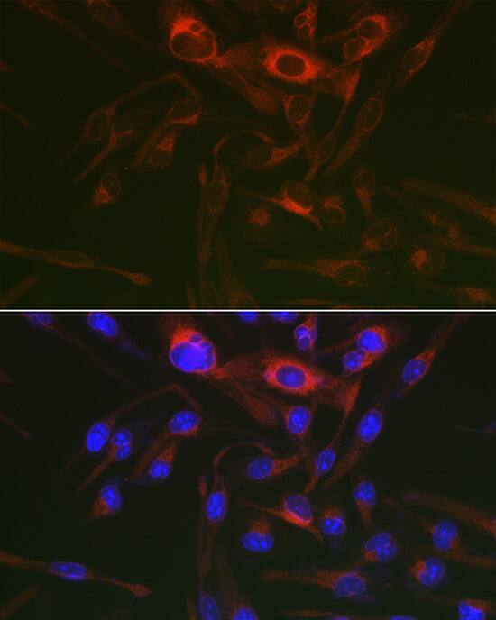 PRKAG3 Antibody - Azide and BSA Free