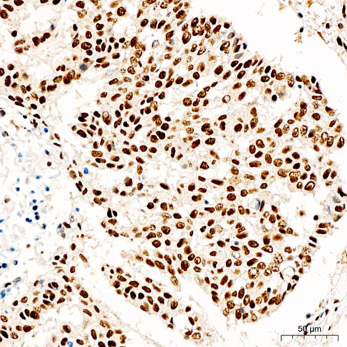 KLHDC2 Antibody - Azide and BSA Free