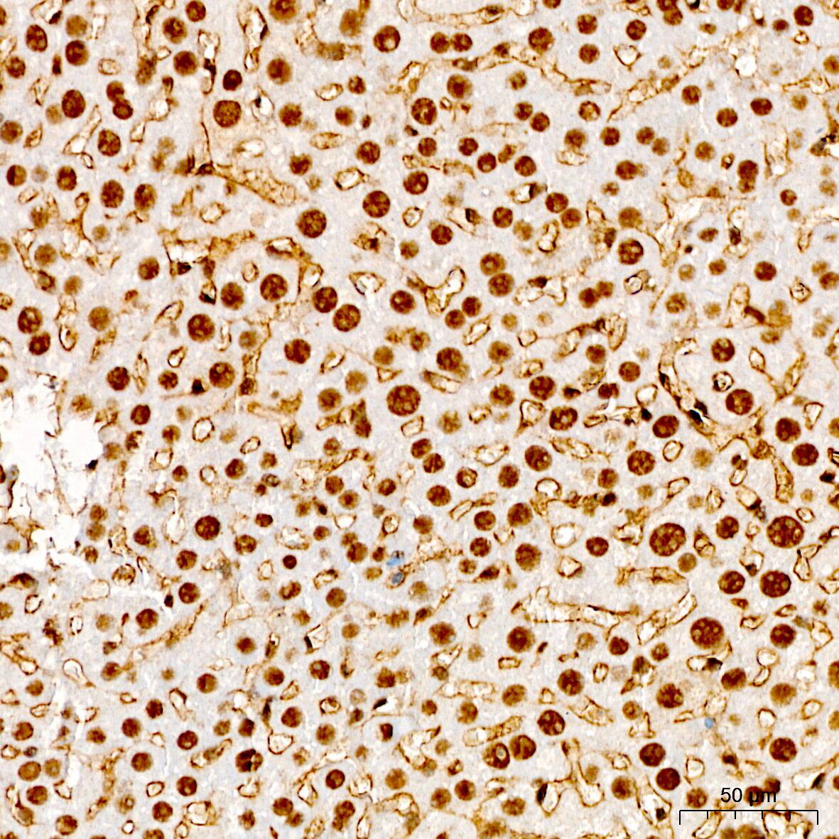 KLHDC2 Antibody - Azide and BSA Free