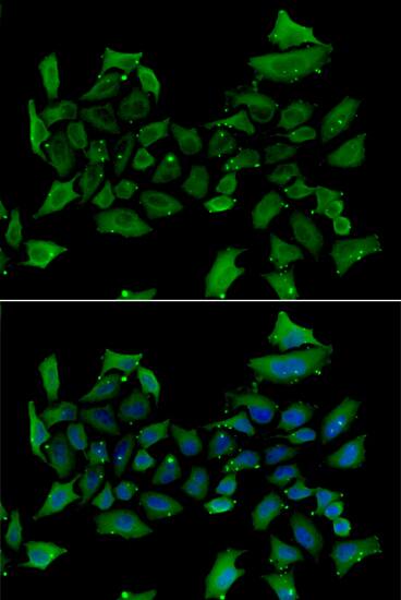 Alas1 Antibody - BSA Free