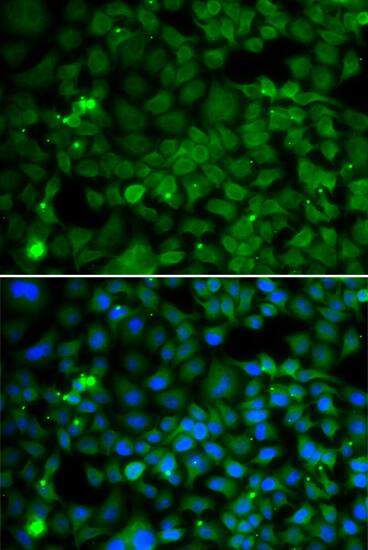 SMYD4 Antibody - Azide and BSA Free