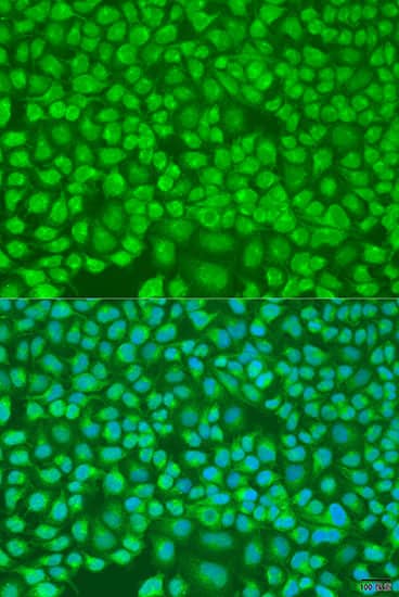 PNKD Antibody - BSA Free