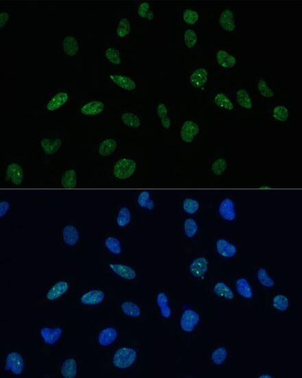 Mkl1 Antibody - BSA Free