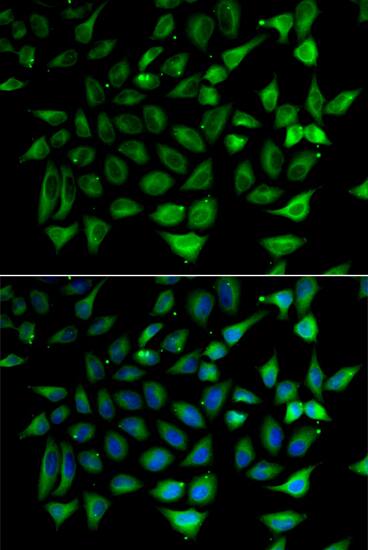 SLC25A20 Antibody - Azide and BSA Free