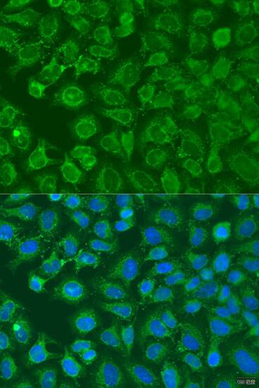 eIF2B1 Antibody - BSA Free