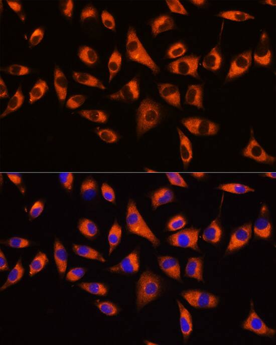 GNB2 Antibody - BSA Free