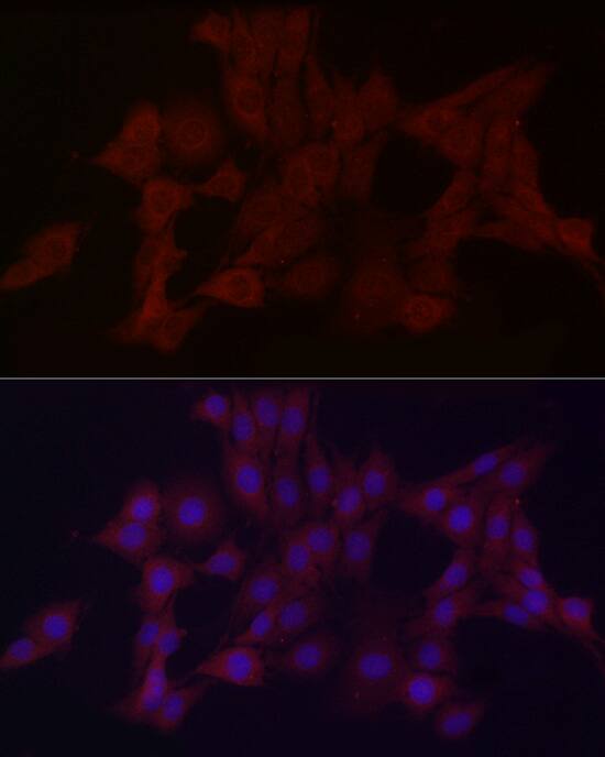 WDR45 Antibody - Azide and BSA Free