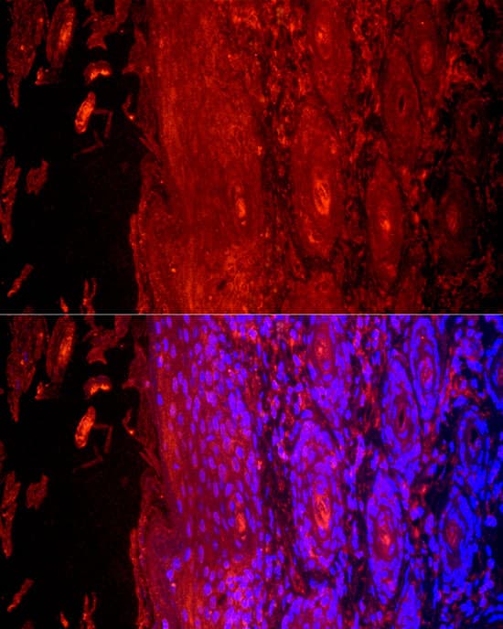 KRT9 Antibody - BSA Free